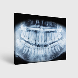 Картина прямоугольная Зубной Рентген