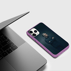 Чехол iPhone 11 Pro матовый Доктор в рубашке, цвет: 3D-фиолетовый — фото 2