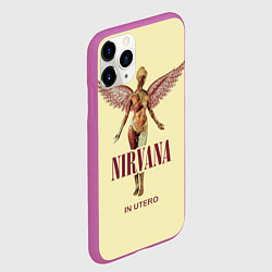 Чехол iPhone 11 Pro матовый Nirvana - In utero, цвет: 3D-фиолетовый — фото 2