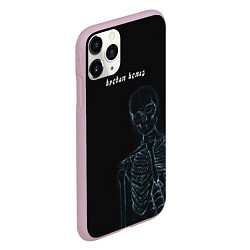 Чехол iPhone 11 Pro матовый Broken bones, цвет: 3D-розовый — фото 2