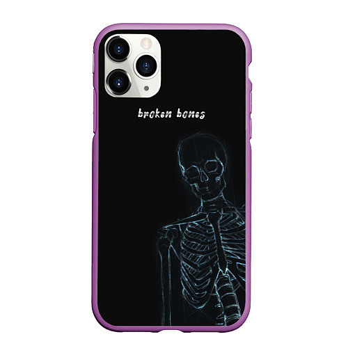 Чехол iPhone 11 Pro матовый Broken bones / 3D-Фиолетовый – фото 1