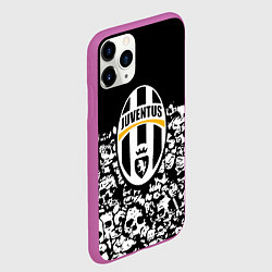 Чехол iPhone 11 Pro матовый Ювентус черно белые черепа, цвет: 3D-фиолетовый — фото 2