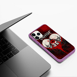 Чехол iPhone 11 Pro матовый BFMV: Duo Skulls, цвет: 3D-фиолетовый — фото 2