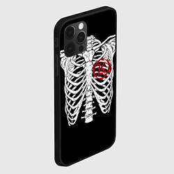 Чехол для iPhone 12 Pro Кукрыниксы: Скелет, цвет: 3D-черный — фото 2