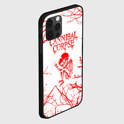 Чехол для iPhone 12 Pro Cannibal Corpse ветки, цвет: 3D-черный — фото 2