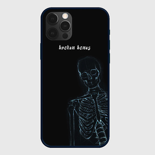 Чехол iPhone 12 Pro Broken bones / 3D-Черный – фото 1