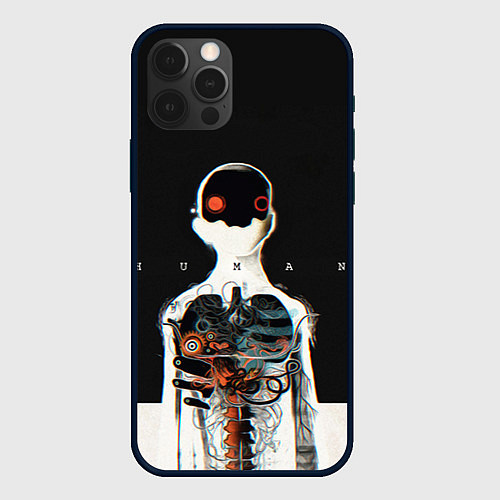 Чехол iPhone 12 Pro Three Days Grace: Skeleton / 3D-Черный – фото 1