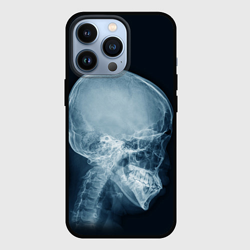 Чехол iPhone 13 Pro Рентген головы / 3D-Черный – фото 1