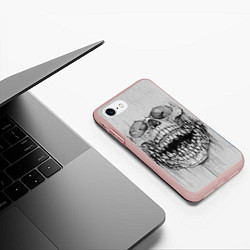 Чехол iPhone 7/8 матовый Dentist skull, цвет: 3D-светло-розовый — фото 2