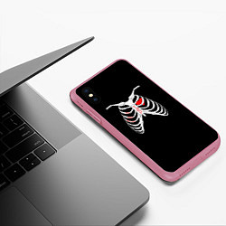 Чехол iPhone XS Max матовый TOP Skeleton, цвет: 3D-малиновый — фото 2