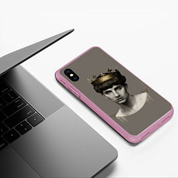 Чехол iPhone XS Max матовый Король Тимоти, цвет: 3D-розовый — фото 2