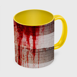 Кружка 3D Бинты 1, цвет: 3D-белый + желтый